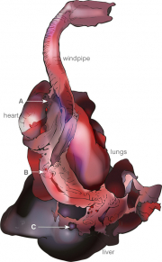 pluck nodes. A: bronchial; B: mediastinal; C: portal